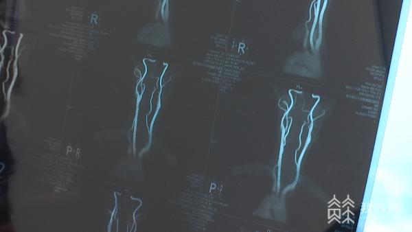 熊猫体育平台@健身爱好者收好这份冬季运动小贴士(图3)